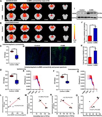 Xiaoyaosan Exerts Antidepressant Effect by Downregulating RAGE Expression in Cingulate Gyrus of Depressive-Like Mice